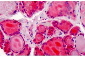 Human Thyroid: Formalin-Fixed, Paraffin-Embedded (FFPE) (XPO1 anticorps  (AA 390-408))