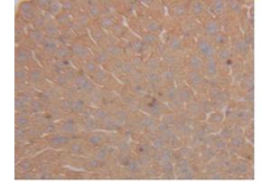 IHC-P analysis of Mouse Liver Tissue, with DAB staining. (Cytokeratin 18 anticorps  (AA 1-423))