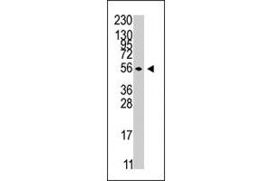 The STK38 polyclonal antibody  is used in Western blot to detect STK38 in Jurkat cell line lysates . (STK38 anticorps  (C-Term))