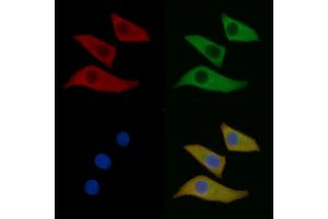 OPRM1 Mouse Monoclonal Antibody staining Hela cells by IF/ICC. (Mu Opioid Receptor 1 anticorps  (C-Term))