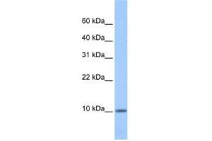 WB Suggested Anti-C20orf141 Antibody Titration: 0. (C20orf141 anticorps  (Middle Region))