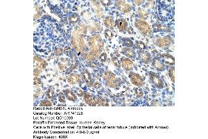 Immunohistochemistry (IHC) image for anti-Guanine Nucleotide Binding Protein (G Protein), beta Polypeptide 1-Like (GNB1L) (C-Term) antibody (ABIN2776748)