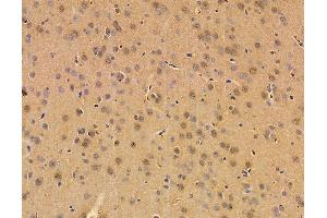 ABIN7095908 and ABIN7099970 at 1/100 staining rat brain tissue by IHC-P. (RNP anticorps)