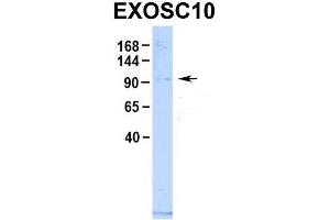 Host:  Rabbit  Target Name:  EXOSC10  Sample Type:  Human 293T  Antibody Dilution:  1. (EXOSC10 anticorps  (C-Term))
