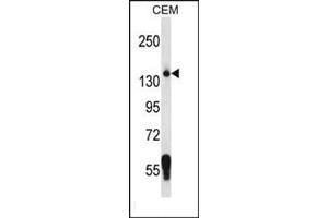 Western blot analysis using SF3B3 Antibody (C-term) Cat. (SF3B3 anticorps  (C-Term))