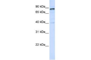 WB Suggested Anti-DNM1 Antibody Titration: 0. (Dynamin 1 anticorps  (Middle Region))