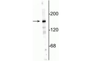 Western blot of 10 µg of rat hippocampal lysate showing specific immunolabeling of the ~180 kDa NR2A subunit. (NMDAR2A anticorps  (N-Term))