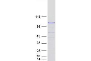 Validation with Western Blot