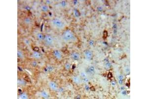 IHC-P analysis of Brain tissue, with DAB staining. (Growth Hormone 1 anticorps  (AA 28-217))