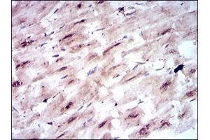 Immunohistochemical analysis of paraffin-embedded cardiac muscle tissues using SLC2A4 mouse mAb with DAB staining.