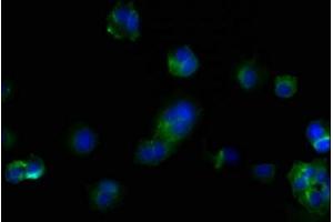 Immunofluorescence staining of MCF-7 cells with ABIN7147160 at 1:100, counter-stained with DAPI.