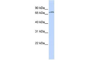 WB Suggested Anti-ZNF768 Antibody Titration: 0. (ZNF768 anticorps  (N-Term))