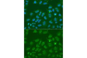 Immunofluorescence analysis of A549 cells using ORC6 antibody. (ORC6 anticorps  (AA 1-252))
