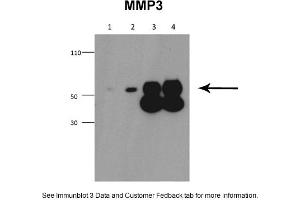 Sample Type: 1. (MMP3 anticorps  (Middle Region))