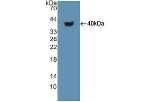 Detection of Recombinant HDGF, Human using Polyclonal Antibody to Hepatoma Derived Growth Factor (HDGF) (HDGF anticorps  (AA 10-240))