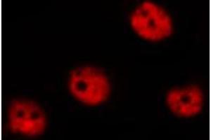 ABIN6267315 staining MOLT by IF/ICC. (Retinoblastoma 1 anticorps  (pSer780))