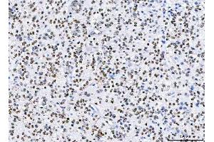 IHC analysis of HnRNP H/HNRNPH1 using anti-HnRNP H/HNRNPH1 antibody (ABIN4886623). (HNRNPH1 anticorps  (N-Term))