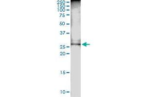 Immunoprecipitation of DCUN1D1 transfected lysate using anti-DCUN1D1 MaxPab rabbit polyclonal antibody and Protein A Magnetic Bead , and immunoblotted with DCUN1D1 MaxPab mouse polyclonal antibody (B01) .