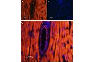 Expression of TRPML2 in rat heart - Immunohistochemical staining of rat heart paraffin-embedded sections using Anti-TRPML2 (Mucolipin-2) Antibody (ABIN7043337, ABIN7044041 and ABIN7044042), followed by AlexaFluor-555 secondary antibody.