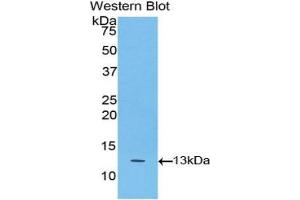 Western Blotting (WB) image for anti-Tumor Necrosis Factor Receptor Superfamily, Member 13C (TNFRSF13C) (AA 96-184) antibody (ABIN3208908) (TNFRSF13C anticorps  (AA 96-184))