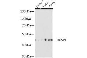 Western blot analysis of extracts of various cell lines, using DUSP4 antibody (ABIN3016539, ABIN3016540, ABIN3016541 and ABIN6219776) at 1:3000 dilution. (DUSP4 anticorps  (AA 1-168))