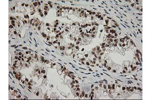 Image no. 16 for anti-Excision Repair Cross-Complementing Rodent Repair Deficiency, Complementation Group 4 (ERCC4) antibody (ABIN1498070)