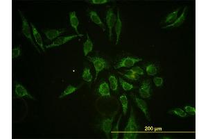 Immunofluorescence of monoclonal antibody to HTRA2 on HeLa cell. (HTRA2 anticorps  (AA 359-458))