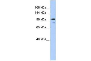 Human 293T; WB Suggested Anti-AMOTL1 Antibody Titration: 0. (AMOTL1 anticorps  (N-Term))