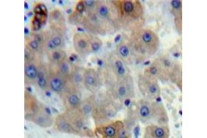 Used in DAB staining on fromalin fixed paraffin-embedded Liver tissue (gamma Lipotropin (AA 179-234) anticorps)