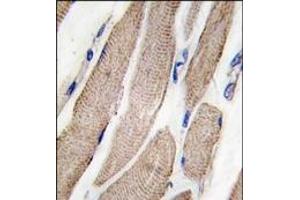 Image no. 1 for anti-Mitogen-Activated Protein Kinase Kinase 5 (MAP2K5) (Ser149) antibody (ABIN360284)