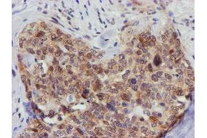 Image no. 1 for anti-F-Box Protein 21 (FBXO21) antibody (ABIN1498235)