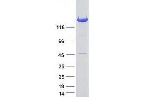 Validation with Western Blot