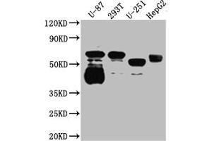 Western Blot Positive WB detected in: U-87 whole cell lysate, 293T whole cell lysate, U-251 whole cell lysate, HepG2 whole cell lysate All lanes: Serotonin transporter antibody at 1:1000 Secondary Goat polyclonal to rabbit IgG at 1/50000 dilution Predicted band size: 71, 75 kDa Observed band size: 55 kDa