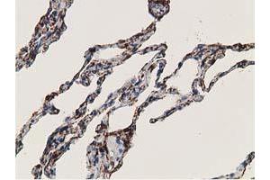 Image no. 6 for anti-Alcohol Dehydrogenase 1B (Class I), beta Polypeptide (ADH1B) antibody (ABIN1496477)