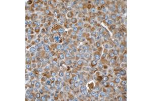 Immunohistochemistry (IHC) image for anti-Vimentin (VIM) (AA 325-375) antibody (ABIN7449539)