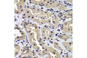 Immunohistochemistry of paraffin-embedded human kidney using CCAR2 antibody at dilution of 1:100 (x400 lens). (CCAR2 anticorps)