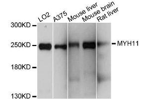 Western blot analysis of extracts of various cell lines, using MYH11 antibody. (MYH11 anticorps  (AA 1680-1979))