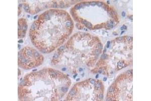 Used in DAB staining on fromalin fixed paraffin- embedded Kidney tissue (CCL14 anticorps  (AA 20-93))