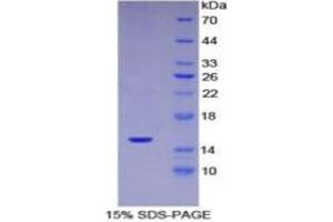 SDS-PAGE of Protein Standard from the Kit  (Highly purified E.