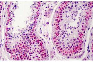 Human Testis: Formalin-Fixed, Paraffin-Embedded (FFPE) (NEK2 anticorps  (AA 287-299))