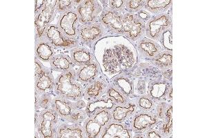 Immunohistochemical staining of human kidney with CGNL1 polyclonal antibody  shows strong luminal membranous positivity in renal tubules at 1:1000-1:2500 dilution.
