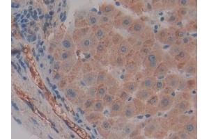 Detection of FGg in Human Liver Tissue using Polyclonal Antibody to Fibrinogen Gamma (FGg)