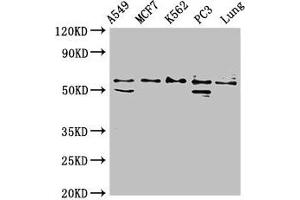 Western Blot Positive WB detected in: A549 whole cell lysate, MCF-7 whole cell lysate, K562 whole cell lysate, PC-3 whole cell lysate, Rat lung tissue All lanes: SERPING1 antibody at 2 μg/mL Secondary Goat polyclonal to rabbit IgG at 1/50000 dilution Predicted band size: 56, 50 kDa Observed band size: 56 kDa (SERPING1 anticorps  (AA 23-300))