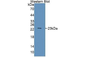 Western blot analysis of the recombinant protein. (ABCA9 anticorps  (AA 1416-1583))