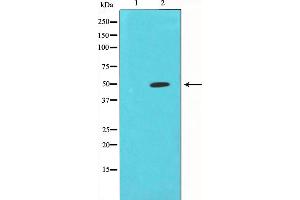 Western blot analysis of extracts from Jurkat cells, using CORO1A antibody. (Coronin 1a anticorps  (Internal Region))
