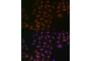 Immunofluorescence analysis of U-2 OS cells using Casein Kinase 2 beta (CSNK2B) (CSNK2B) Rabbit mAb (ABIN1680593, ABIN3019007, ABIN3019008 and ABIN7101698) at dilution of 1:100 (40x lens).