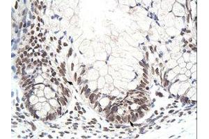 Image no. 1 for anti-Zinc Finger Protein 394 (ZNF394) (N-Term) antibody (ABIN6736210)