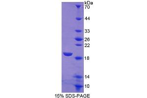 SDS-PAGE analysis of Human SIGLEC7 Protein. (SIGLEC7 Protéine)