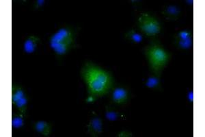 Anti-NIT2 mouse monoclonal antibody (ABIN2453355) immunofluorescent staining of COS7 cells transiently transfected by pCMV6-ENTRY NIT2 (RC210660). (NIT2 anticorps)