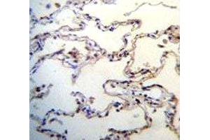 RAGE antibody immunohistochemistry analysis in formalin fixed and paraffin embedded human lung tissue.